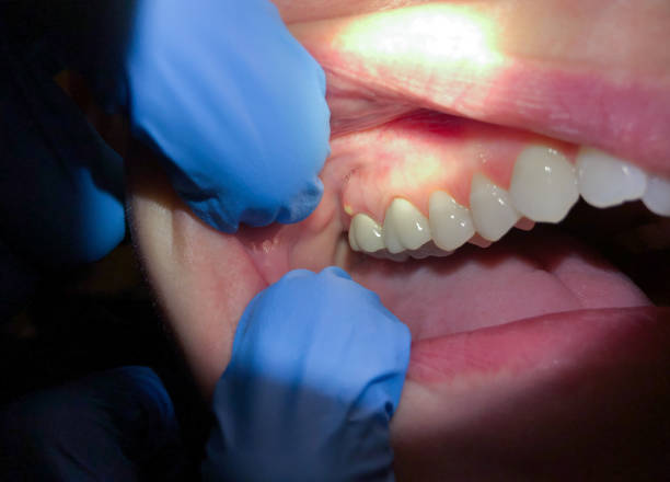 Best Emergency Dental Care for Trauma or Injury in White Mountain Lake, AZ